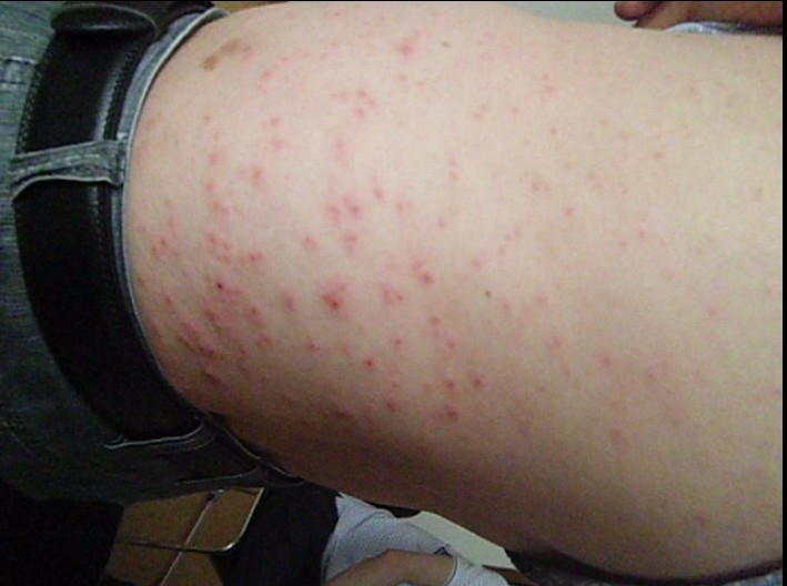 患者症状