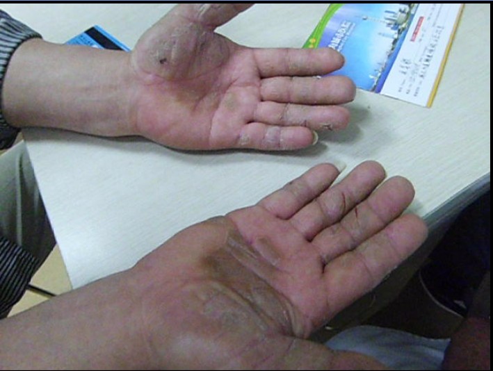 患者症状
