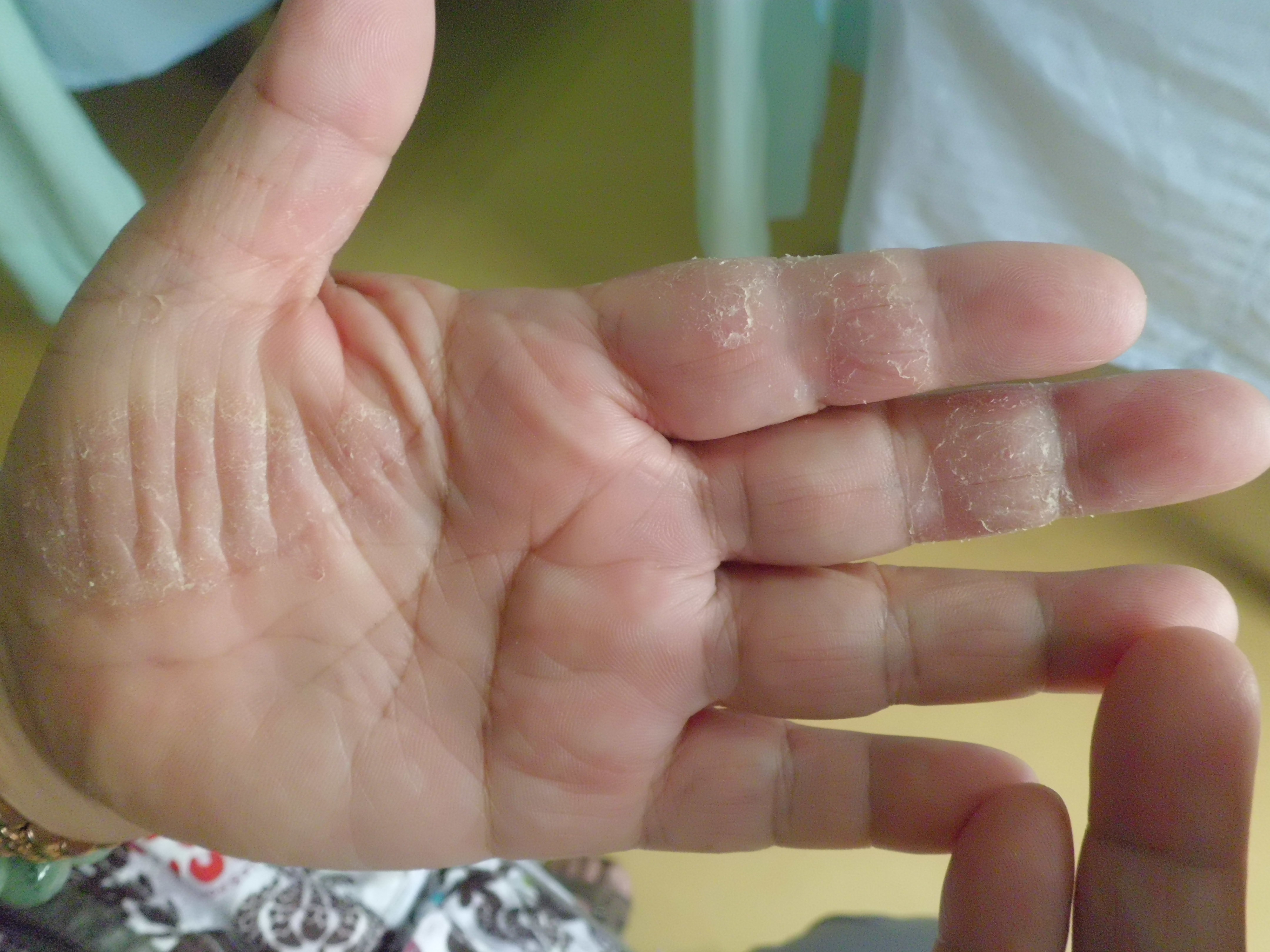 患者正在接受治疗